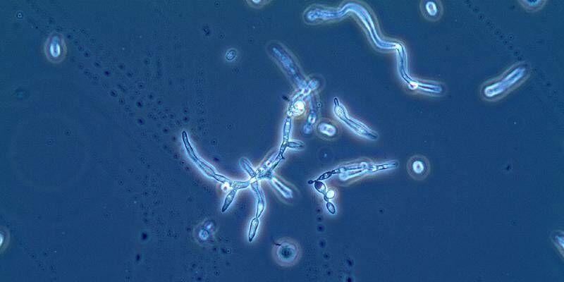 Yeast In Culture 3 Weeksima1